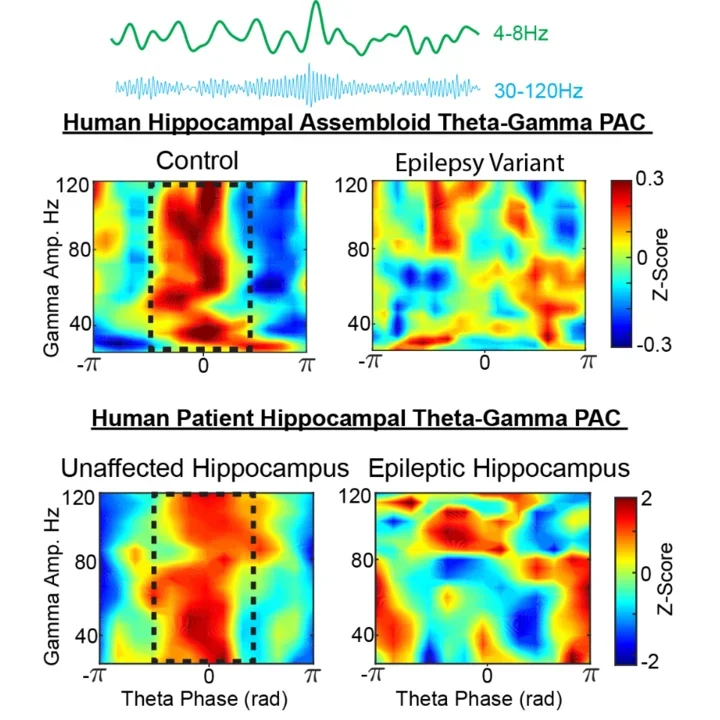 Images of theta and gamma filtered oscillations taken from a hippocampal assembloid.