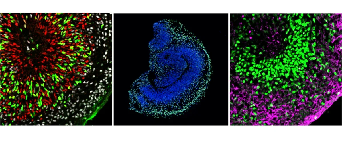 Organoids immunostained with fluorescent markers.
