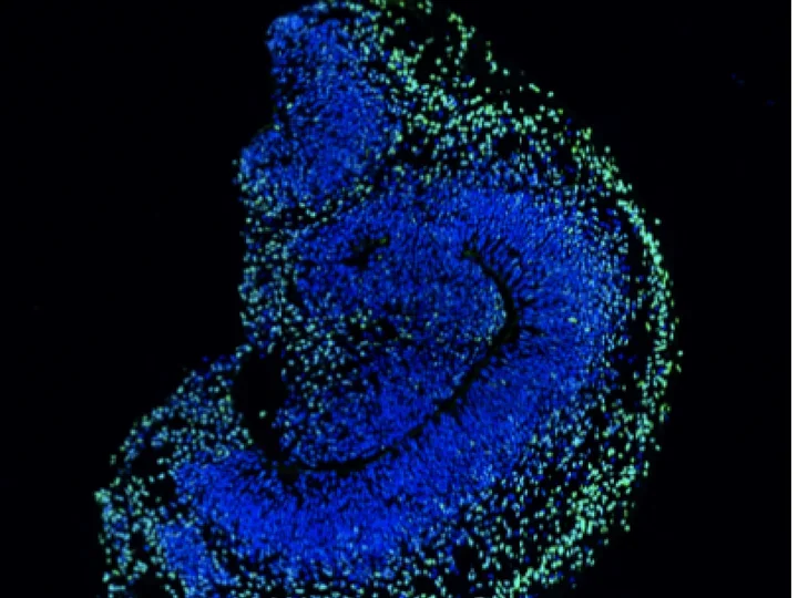 Organoids immunostained with fluorescent markers.