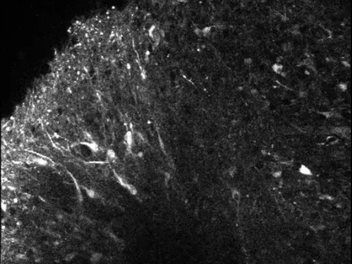 An organoid expressing a genetically encoded calcium indicator during a multiphoton imaging session.