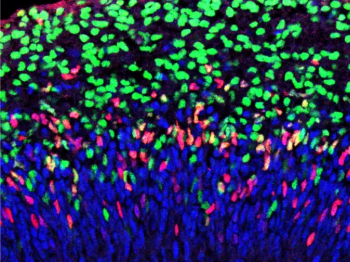 Blue, red, and green cell close-up.