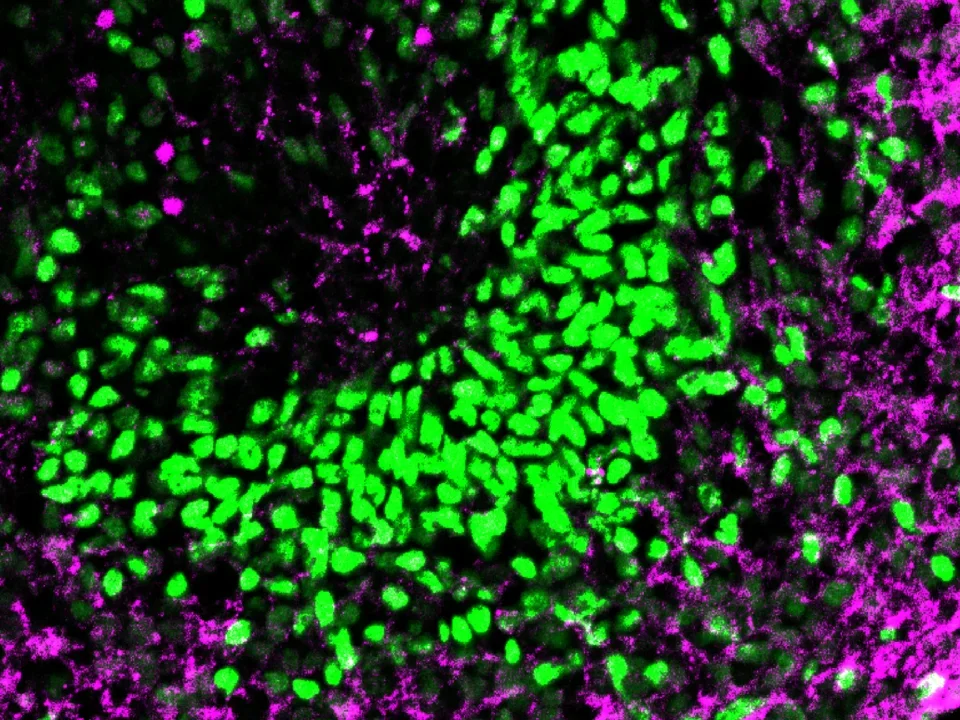 A cross section of organoids immunostained with fluorescent markers for neural progenitor cells and mature neurons.