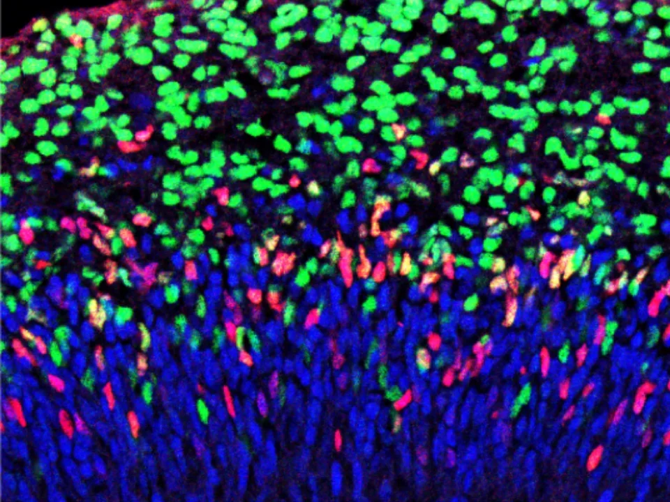 Blue, red, and green cell close-up.